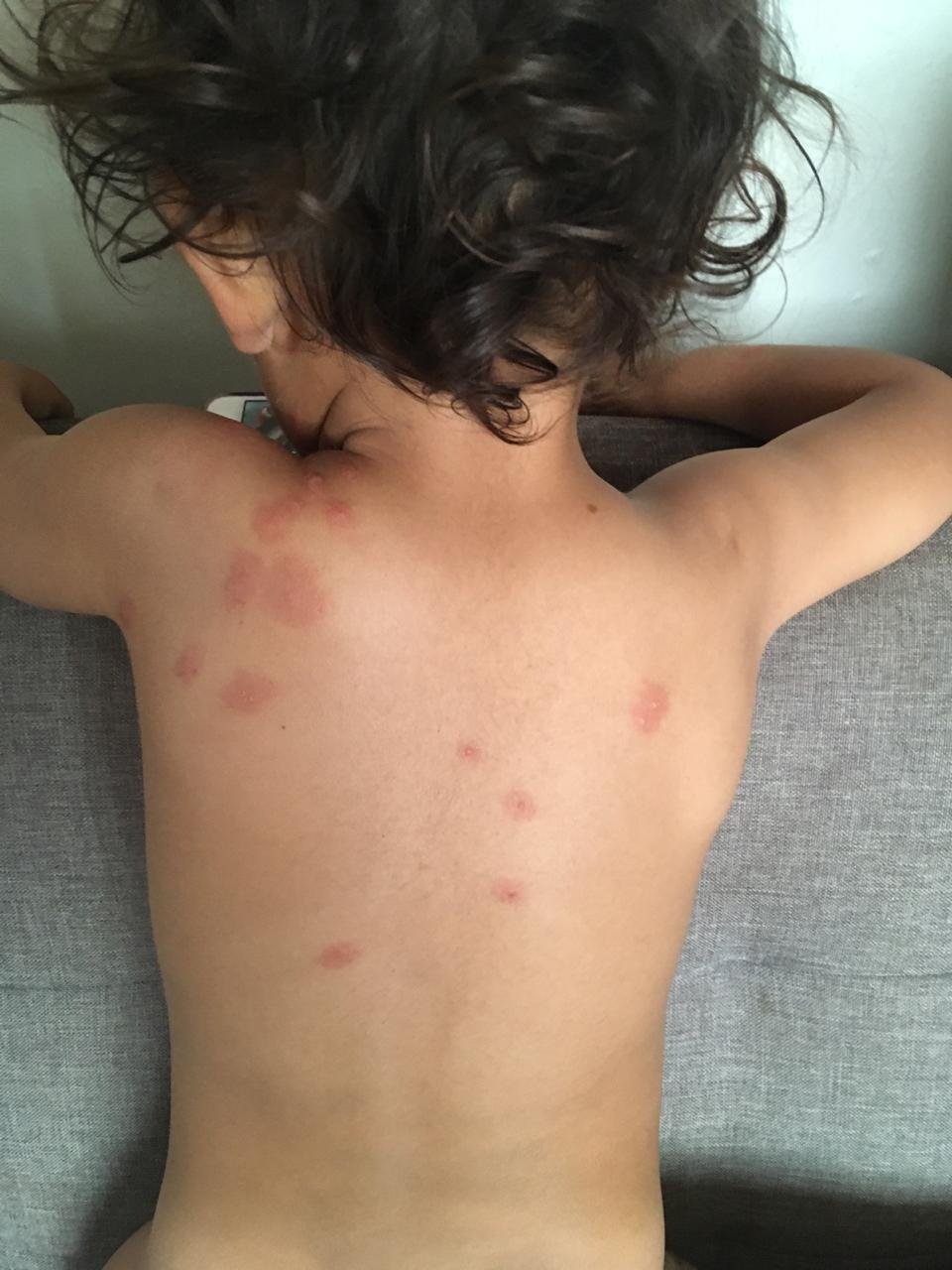 LECHE DE VACA, SOYA Y ARROZ SERÍAN LAS PRINCIPALES ALERGIAS ALIMENTARIAS EN NIÑOS CHILENOS