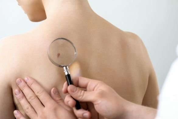 “HOY SE OBSERVA MAYOR CONCIENCIA ACERCA DEL CUIDADO DE LA PIEL Y LA PREVENCIÓN DEL CÁNCER”